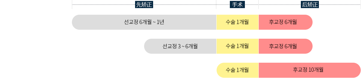 수술 시기별 양악수술 종류-선교정, 최소교정수술, 선수술